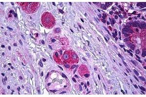 Human Intestine, Ganglion Cells: Formalin-Fixed, Paraffin-Embedded (FFPE) (SSBP2 antibody  (AA 10-59))