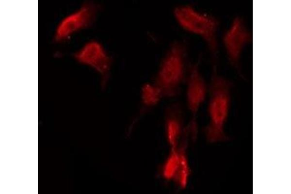 GPRC6A antibody  (Internal Region)