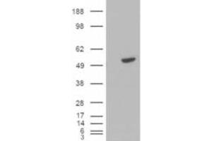 Western Blotting (WB) image for anti-B-Cell Linker (BLNK) antibody (ABIN5913298) (B-Cell Linker antibody)