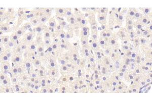 Detection of Raftlin in Mouse Liver Tissue using Polyclonal Antibody to Raft Linking Protein (Raftlin) (RFTN1 antibody  (AA 207-451))