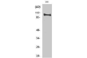 Western Blotting (WB) image for anti-HRS (HRS) (Tyr426) antibody (ABIN3185084) (HRS (HRS) (Tyr426) antibody)