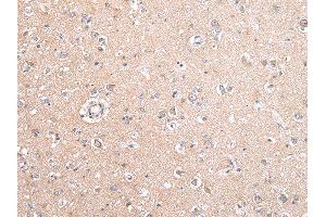 Immunohistochemistry (IHC) image for anti-Gap Junction Protein, beta 5, 31,1kDa (GJB5) antibody (ABIN5959318) (GJB5 antibody)