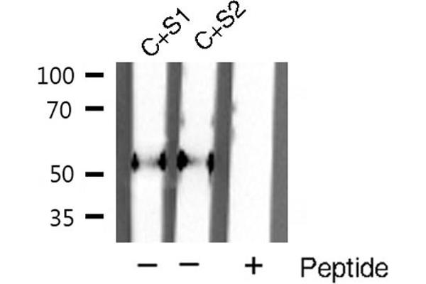 SMAD2 antibody  (C-Term)