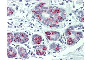 Anti-ITGA6 / CD49f antibody IHC of human breast. (ITGA6 antibody  (Internal Region))