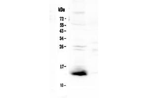 Western blot analysis of TFF2 using anti-TFF2 antibody . (Trefoil Factor 2 antibody  (AA 24-129))