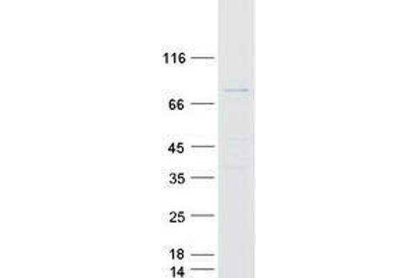 ZNF238 Protein (Transcript Variant 1) (Myc-DYKDDDDK Tag)