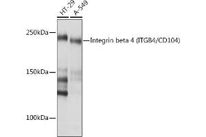 Western blot analysis of extracts of various cell lines, using Integrin beta 4 (ITGB4/CD104) (ITGB4/CD104) Rabbit mAb (ABIN7267931) at 1:1000 dilution. (Integrin beta 4 antibody)