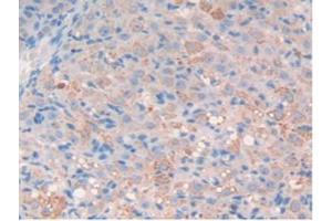 Figure. (MMP11 antibody  (AA 287-491))