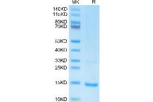 undefined on Tris-Bis PAGE under reduced condition. (MPXV A29L (AA 1-110) protein (His tag))