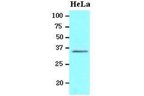 BRCC3 antibody  (N-Term)