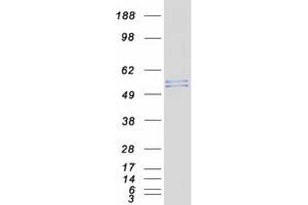 AJUBA Protein (Transcript Variant 1) (Myc-DYKDDDDK Tag)