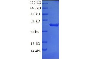 SDS-PAGE (SDS) image for Tissue Factor Pathway Inhibitor (Lipoprotein-Associated Coagulation Inhibitor) (TFPI) (AA 25-300) protein (His tag) (ABIN5713886) (TFPI Protein (AA 25-300) (His tag))