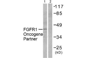 Western Blotting (WB) image for anti-FGFR1 Oncogene Partner (FGFR1OP) (C-Term) antibody (ABIN1848539) (FGFR1OP antibody  (C-Term))