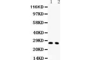 Anti-P27 KIP 1 Picoband antibody,  All lanes: Anti-p27 KIP 1 at 0. (CDKN1B antibody  (AA 10-198))