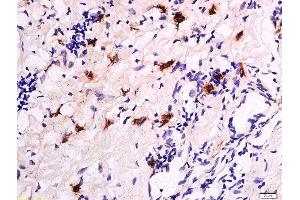 Immunohistochemistry (Paraffin-embedded Sections) (IHC (p)) image for anti-Catenin, beta (CATNB) (pSer33), (pSer37) antibody (ABIN683893)