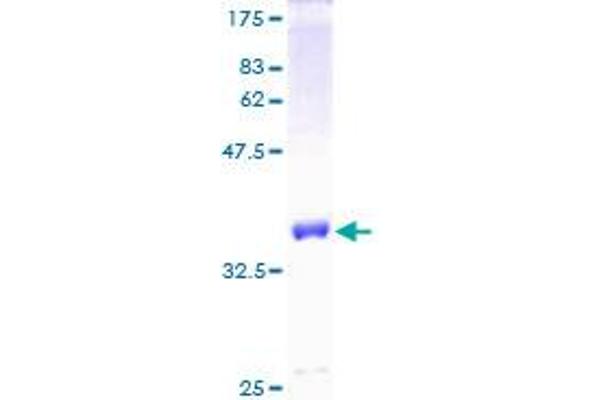 S100A1 Protein (AA 1-94) (GST tag)