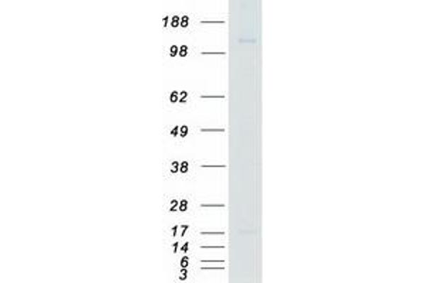 GAK Protein (Myc-DYKDDDDK Tag)