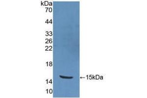 Western blot analysis of recombinant Human PKIb. (PKIB antibody  (AA 8-76))