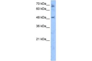 Western Blotting (WB) image for anti-Membrane Bound O-Acyltransferase Domain Containing 7 (MBOAT7) antibody (ABIN2463293) (MBOAT7 antibody)