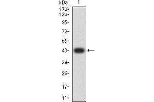Western blot analysis using CD61 mAb against human CD61 (AA: extra 27-179) recombinant protein. (Integrin beta 3 antibody  (AA 27-179))