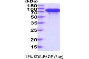 SDS-PAGE (SDS) image for DsbC (AA 21-236) protein (ABIN7281344) (DsbC (AA 21-236) Protein)