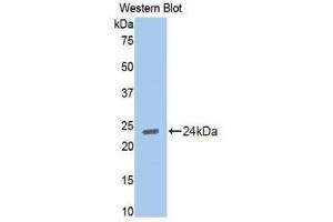 Western Blotting (WB) image for anti-Cadherin 2 (CDH2) (AA 384-562) antibody (ABIN1858323) (N-Cadherin antibody  (AA 384-562))