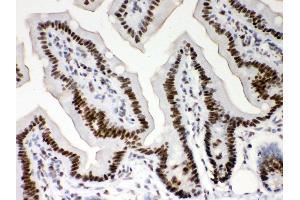 Anti- Nucleophosmin Picoband antibody,IHC(P) IHC(P): Mouse Intestine Tissue (NPM1 antibody  (AA 1-294))