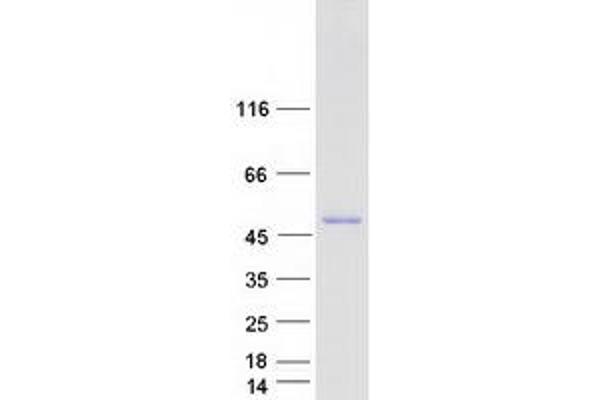 RCC1 Protein (Transcript Variant 3) (Myc-DYKDDDDK Tag)