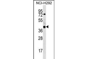 GTPBP10 Antibody (C-term) (ABIN656643 and ABIN2845886) western blot analysis in NCI- cell line lysates (35 μg/lane). (GTPBP10 antibody  (C-Term))