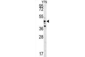 Western Blotting (WB) image for anti-Nemo-Like Kinase (NLK) (Thr286) antibody (ABIN3003279) (Nemo-Like Kinase antibody  (Thr286))