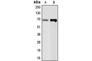 Western blot analysis of Chromogranin A expression in PC12 (A), SHSY5Y (B) whole cell lysates. (Chromogranin A antibody  (Center))