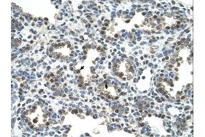 Glycoprotein antibody was used for immunohistochemistry at a concentration of 4-8 ug/ml. (Glycoprotein antibody)