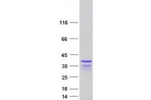 PPHLN1 Protein (Transcript Variant 8) (Myc-DYKDDDDK Tag)