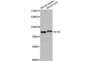 Western blot analysis of extracts of various cell lines, using IFI16 antibody (ABIN6291165) at 1:1000 dilution. (IFI16 antibody)