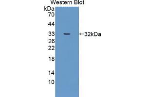 Western blot analysis of the recombinant protein. (Dickkopf-Like 1 (DKKL1) (AA 21-230) antibody)