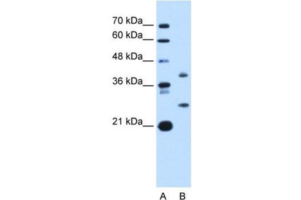 ST8SIA2 Antikörper  (C-Term)