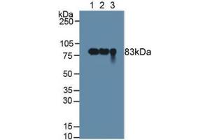 Western blot analysis of (1) Human Milk, (2) Human Urine and (3) Human Saliva. (PIGR antibody  (AA 462-561))