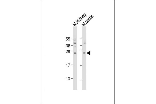 TREM2 antibody  (N-Term)