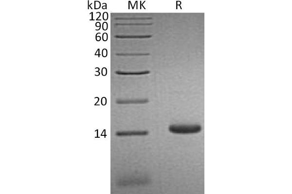 CCL3L1 Protein (His tag)