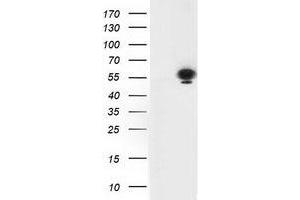 HEK293T cells were transfected with the pCMV6-ENTRY control (Left lane) or pCMV6-ENTRY TP53 (Right lane) cDNA for 48 hrs and lysed. (p53 antibody)