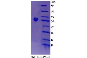 SDS-PAGE analysis of Mouse CHN2 Protein. (CHN2 Protein)