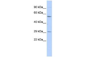 WB Suggested Anti-TRIM62 Antibody Titration:  0. (TRIM62 antibody  (Middle Region))