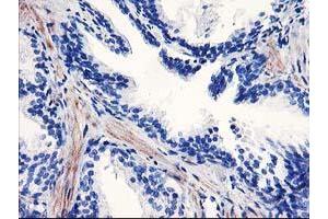 Immunohistochemical staining of paraffin-embedded Human prostate tissue using anti-PPARA mouse monoclonal antibody. (PPARA antibody  (AA 145-420))