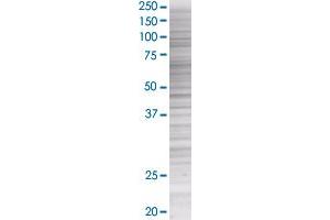 GRN transfected lysate. (GRN 293T Cell Transient Overexpression Lysate(Denatured))