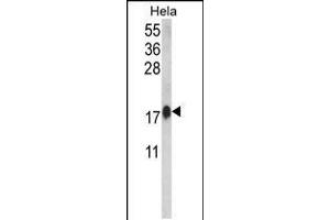 Western blot analysis of CALM1 Antibody in Hela cell line lysates (35ug/lane)(2ug/ml) (Calmodulin 1 antibody  (C-Term))