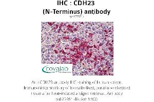 Image no. 1 for anti-Cadherin 23 (CDH23) antibody (ABIN1732920) (CDH23 antibody)