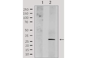 Western blot analysis of extracts from HepG2, using NDFIP1 Antibody. (NDFIP1 antibody  (C-Term))