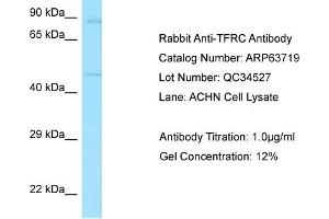 Western Blotting (WB) image for anti-Transferrin Receptor (p90, CD71) (TFRC) (N-Term) antibody (ABIN2789600) (Transferrin Receptor antibody  (N-Term))