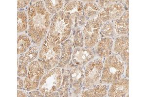 ABIN6267650 at 1/200 staining human kidney tissue sections by IHC-P. (STAT4 antibody  (pTyr693))