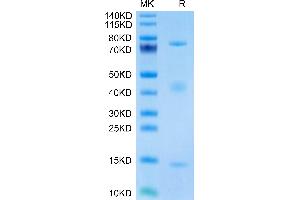 Biotinylated Rat GARP&Latent TGF Beta 1 Complex on Tris-Bis PAGE under reduced condition. (GARP & Latent TGF beta 1 Complex (AA 18-628) protein (His-Avi Tag,Biotin))